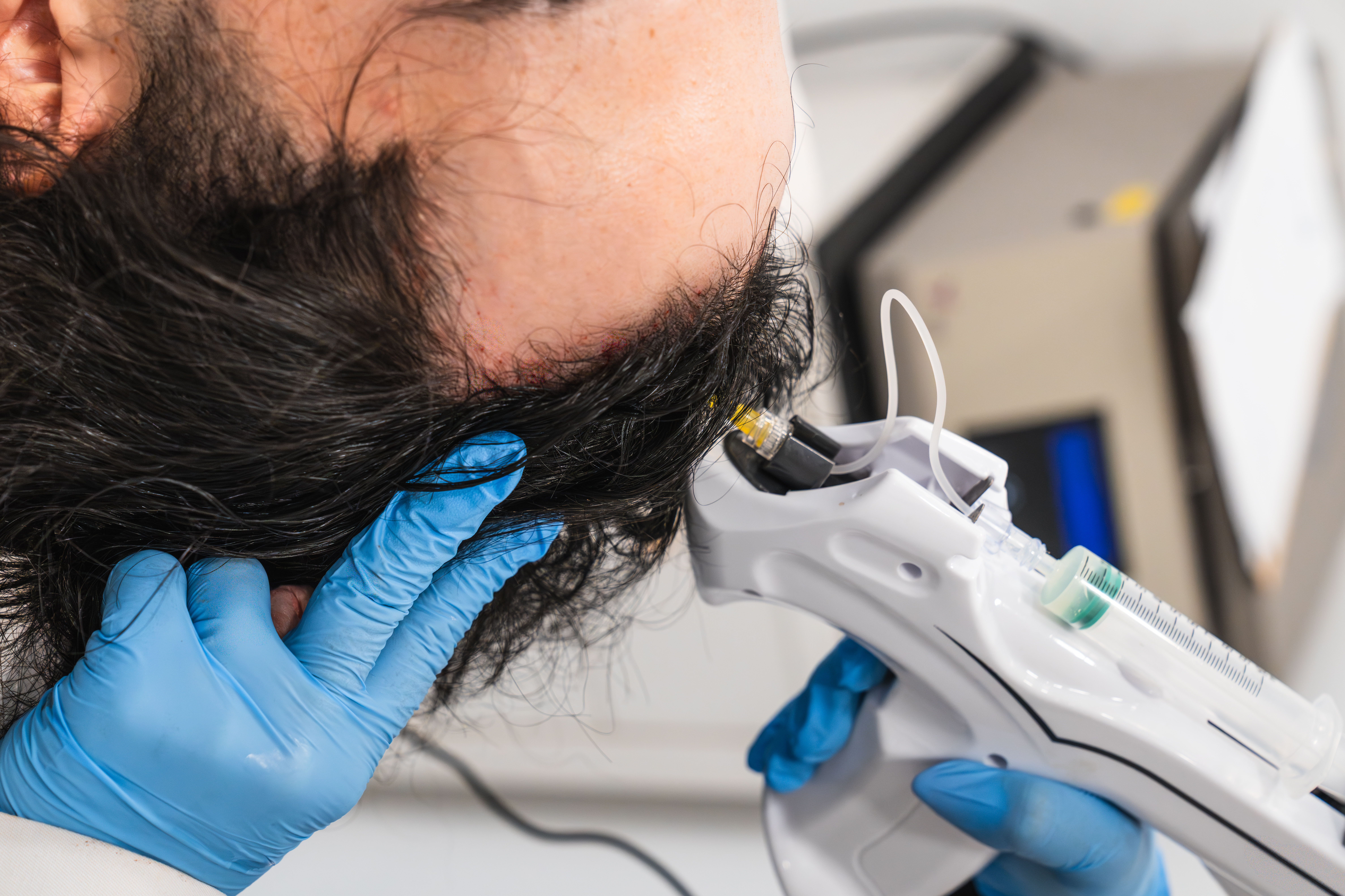 Diseño capilar personalizado