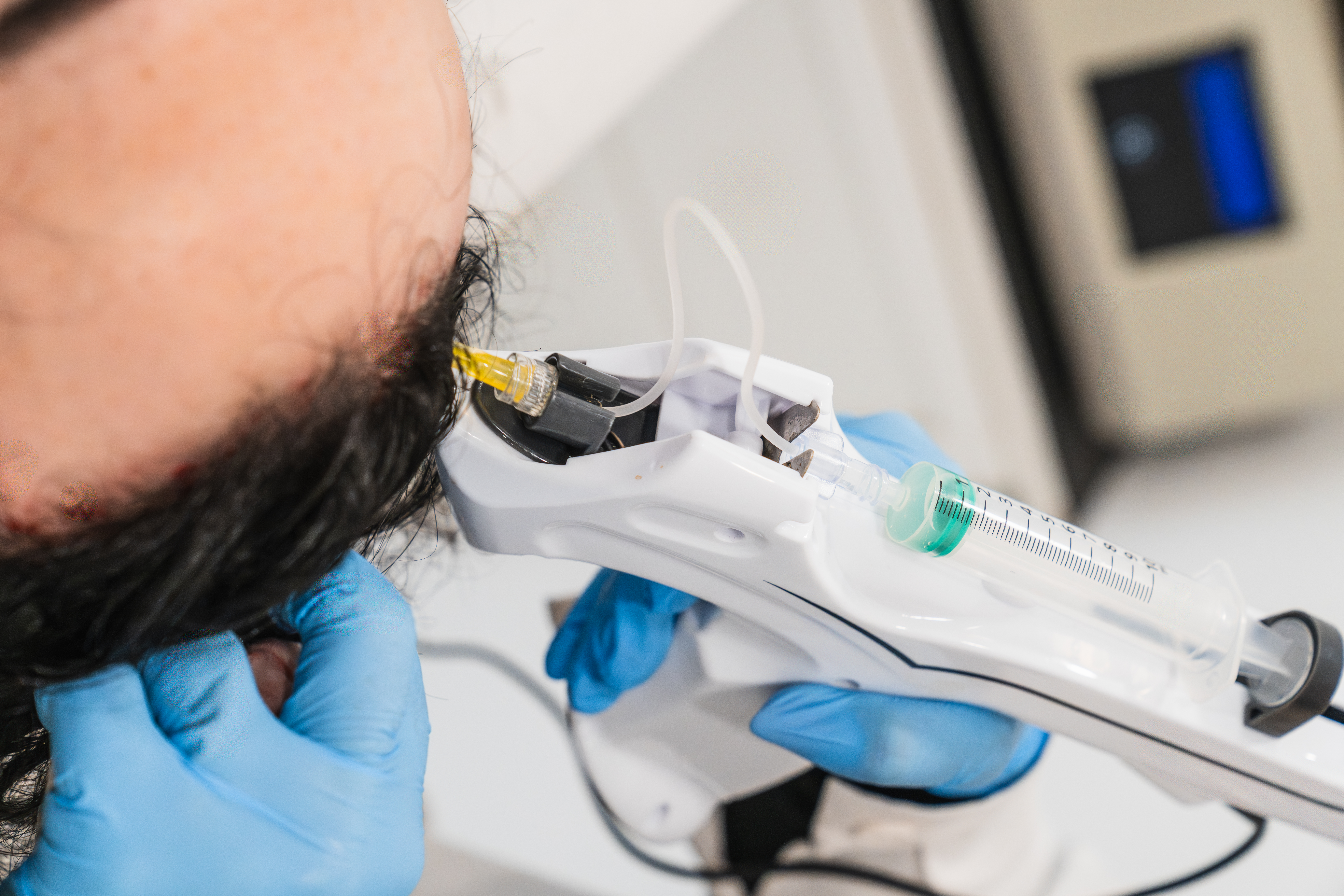 Valoración capilar personalizada